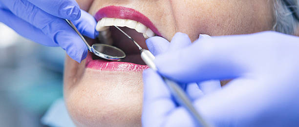 Best Emergency Treatment for Toothache in Windsor, VA
